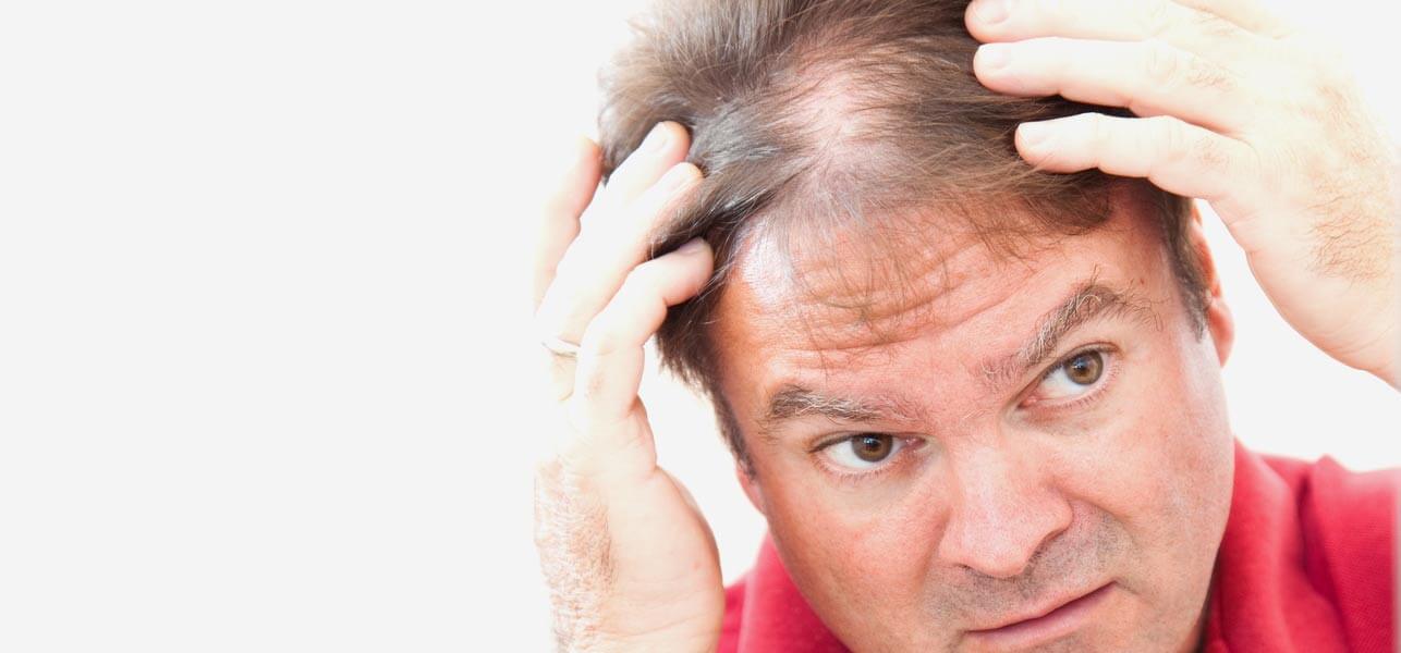 How to Choose Best Hair Transplant in Tricity