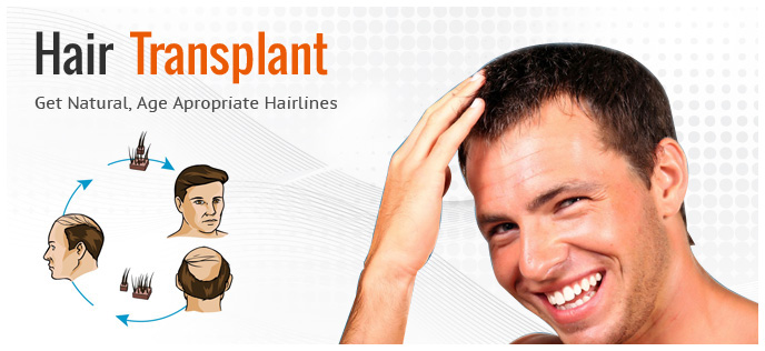 Hair Transplant in Chandigarh 6 1 - Slow The Hair Loss Process With Ease