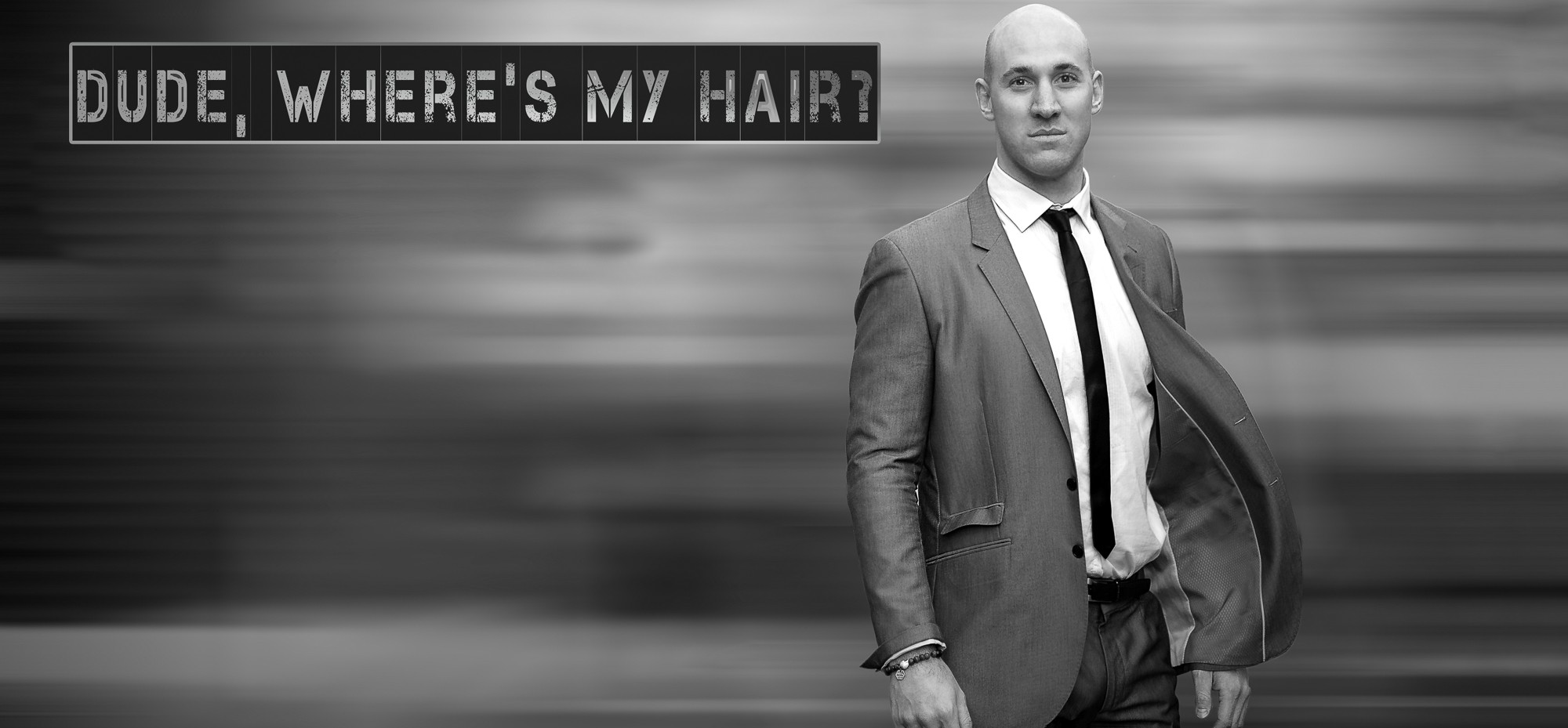 Hair Transplants Chandigarh 5 1 - Restore Hair Over The Bald Spots With FUE Hair Transplants